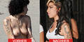 Neue Brüste für Amy Winehouse