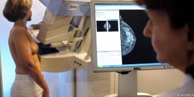 Neue Brustkrebs-Medikamente hemmen &Ouml;strogenbildung