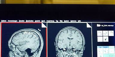 Neue Diagnosemethode