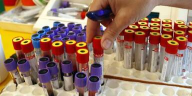 Neue Erkenntnisse zur Entstehung zahlreicher Erkrankungen