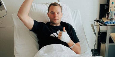 Manuel Neuer Unterschenkelbruch