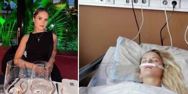 Davina Geiss hat sich einer Nasen-OP unterzogen