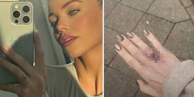 Laura Maria Rypa hat sich Tattoo überstechen lassen