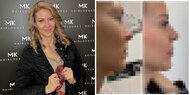 Beauty-Doc-Beichte: DAS hat Simone Lugner jetzt machen lassen!