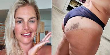 Gesichtsl&auml;hmung und Reitunfall: Curvy-Model Angelina Kirsch ist vom Pech verfolgt