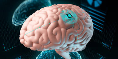 Neuralink: Verbindung von Mensch und Maschine „sehr bald“ Realität