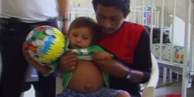 Peru: Dreij&auml;hriger tr&auml;gt Zwilling im Bauch