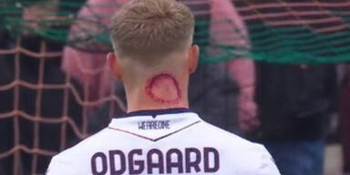 Zombie-Biss? Was ist mit DIESEM Fu&szlig;ball-Star los?