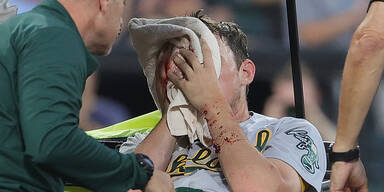 Blutiger Baseball-Schock in MLB