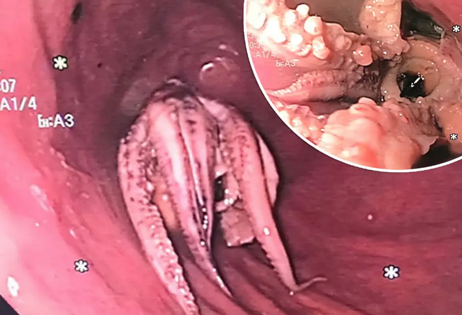 Tan Tock Seng Hospital.