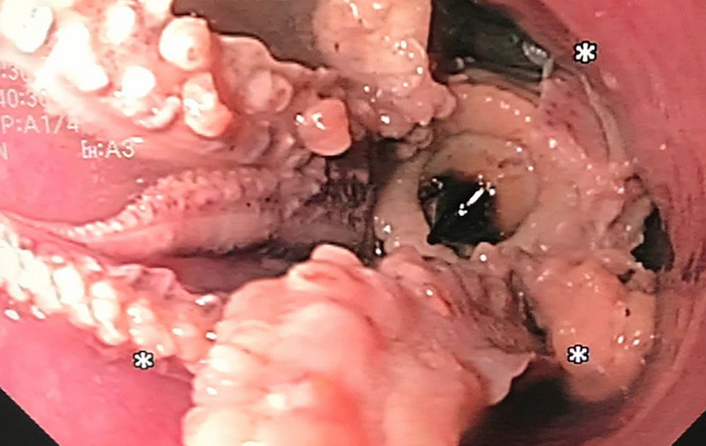 Tan Tock Seng Hospital.