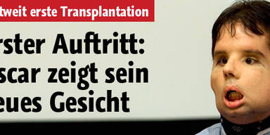 Oscar zeigt sein neues Gesicht