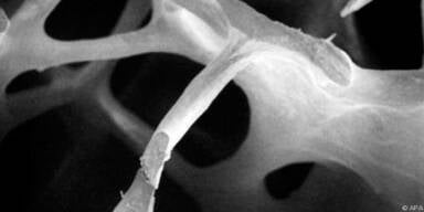 Osteoporose vorbeugen