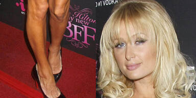 Peinlich! Mogel-Paris versucht's mit Selbstbräuner