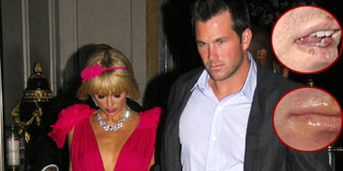 Paris' Lover ließ die Fäuste sprechen