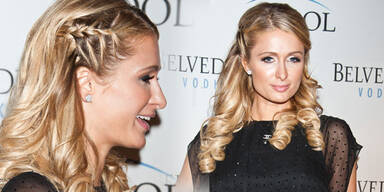 Paris Hilton sucht Trost nach Zahn-OP