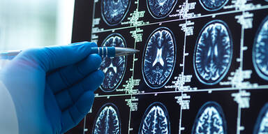 Forscher feiern Durchbruch bei Parkinson-Forschung