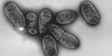 N&auml;chster Pest-Fall in China sorgt f&uuml;r Angst