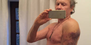 Peter Kraus: Todesangst nach Unfall