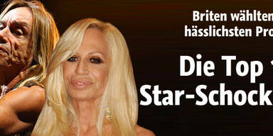 Das sind die hässlichsten Star-Gesichter