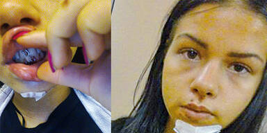 Jetzt spricht das Pr&uuml;gelopfer