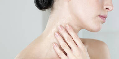 Neue Therapien bei Schuppenflechte