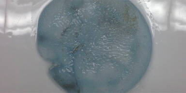 Mann verwechselt Qualle mit Brustimplantat