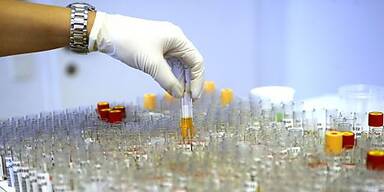 R&uuml;ckf&auml;lle derzeit erst sp&auml;t nachweisbar