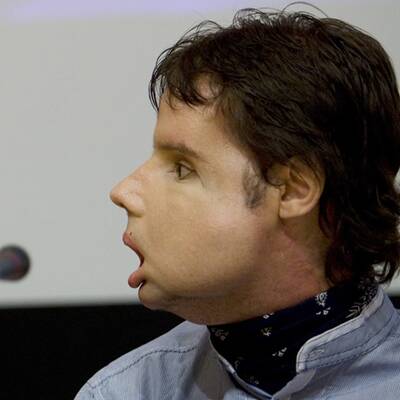 Oscar mit seinem neuen Gesicht