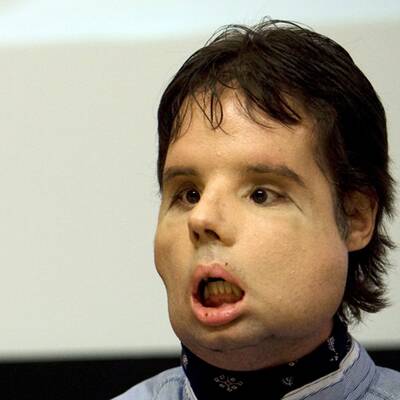 Oscar mit seinem neuen Gesicht