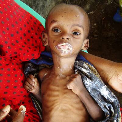 Hungersnot in Somalia und Kenia
