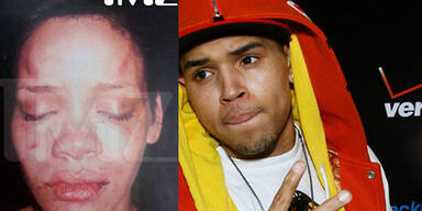 Chris Brown geht zur Antiaggressionstherapie