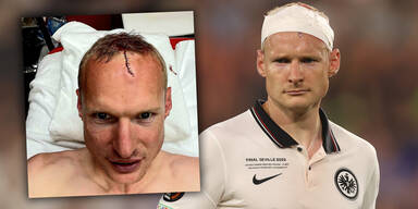 Frankfurt-Kapit&auml;n Rode teilt Foto von Finalwunde