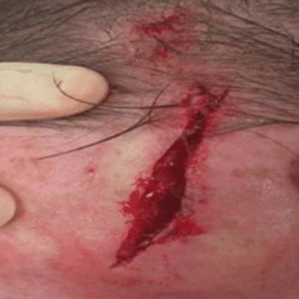 ManU-Star Rooney schockt mit Horror-Foto