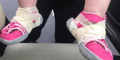 Sandalen festgeklebt