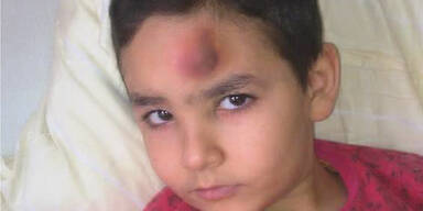 Lehrerin lie&szlig; Sch&uuml;ler mit Beule weiterlernen