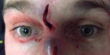 Eishockey-Star postet Horror-Selfie