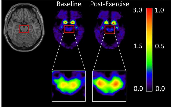 Dopamin Werte Vor und nach dem Training.