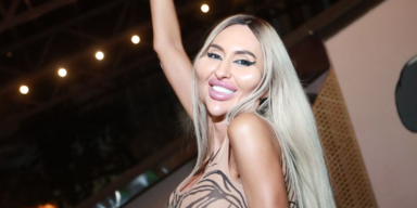 "Gr&ouml;&szlig;te Wangen der Welt": Anastasiia Pokreshchuk zeigt ihre enorme Transformation