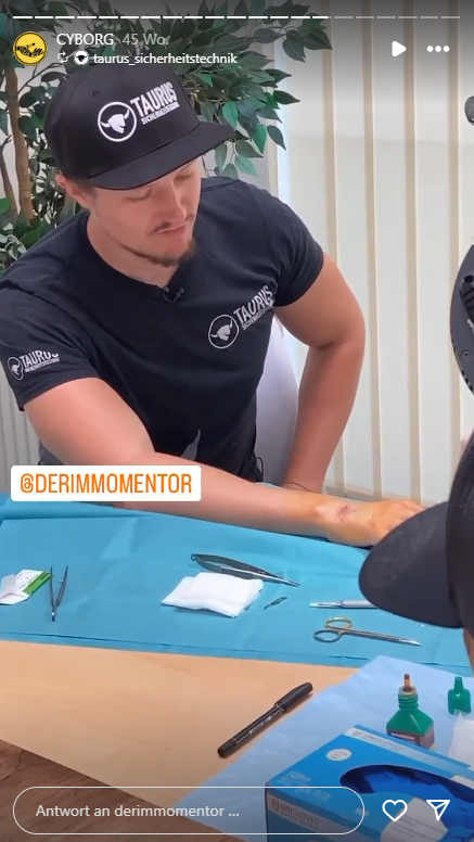 Wiener lässt sich Autoschlüssel implantieren