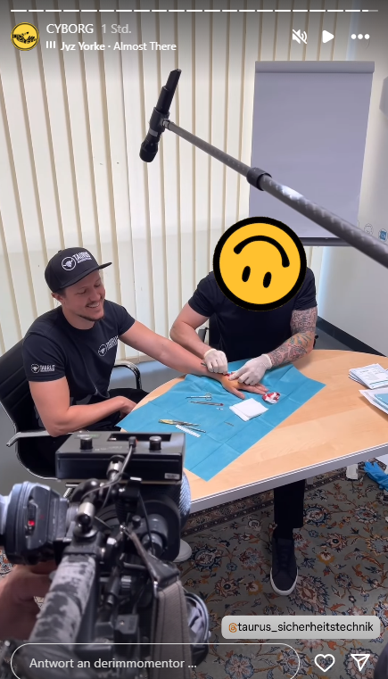 Wiener lässt sich Autoschlüssel implantieren