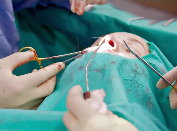 Die Kameras filmten den gesamten Eingriff. 