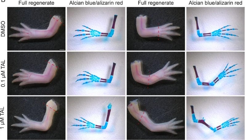Axolotls zeigen unterschiedliche Regenerationen der Gliedmaßen nach Behandlung mit Talarozol. 