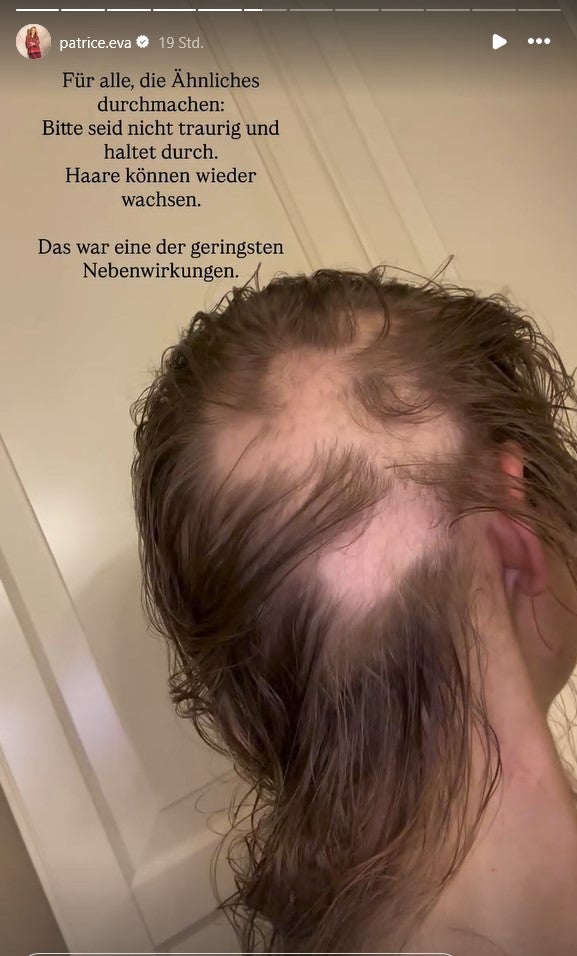 Patrice zeigt, wie ihre Haare wirklich aussehen. 