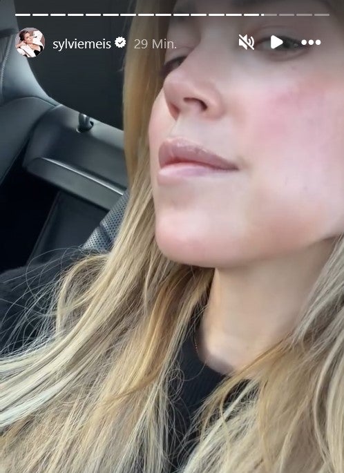 Auf dem Heimweg zeigt Sylvie Meis noch einmal ihre geschwollene Backe. 