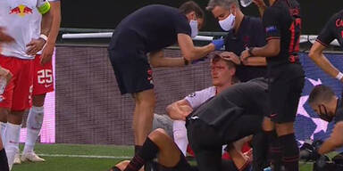 Blutiger Kopfsto&szlig;: Leipzig-Star wird am Spielfeld gen&auml;ht