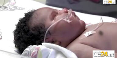 7,3 Kilo schweres Baby in Texas geboren