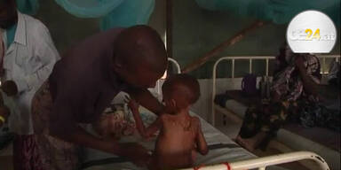 Somalia: Kinder leiden Hunger, Land an Dürre