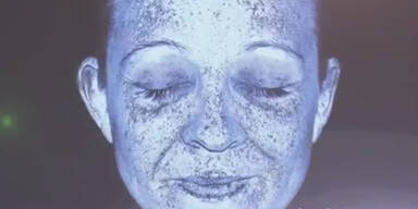 UV-Kamera zeigt Sonnensch&auml;den