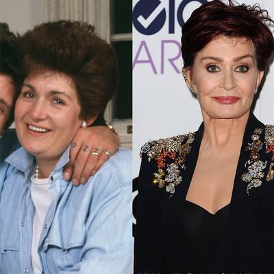 So krass verändern Schönheits-Operationen